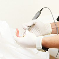 入れ歯（義歯）の作成・調整