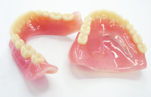 入れ歯治療のイメージ