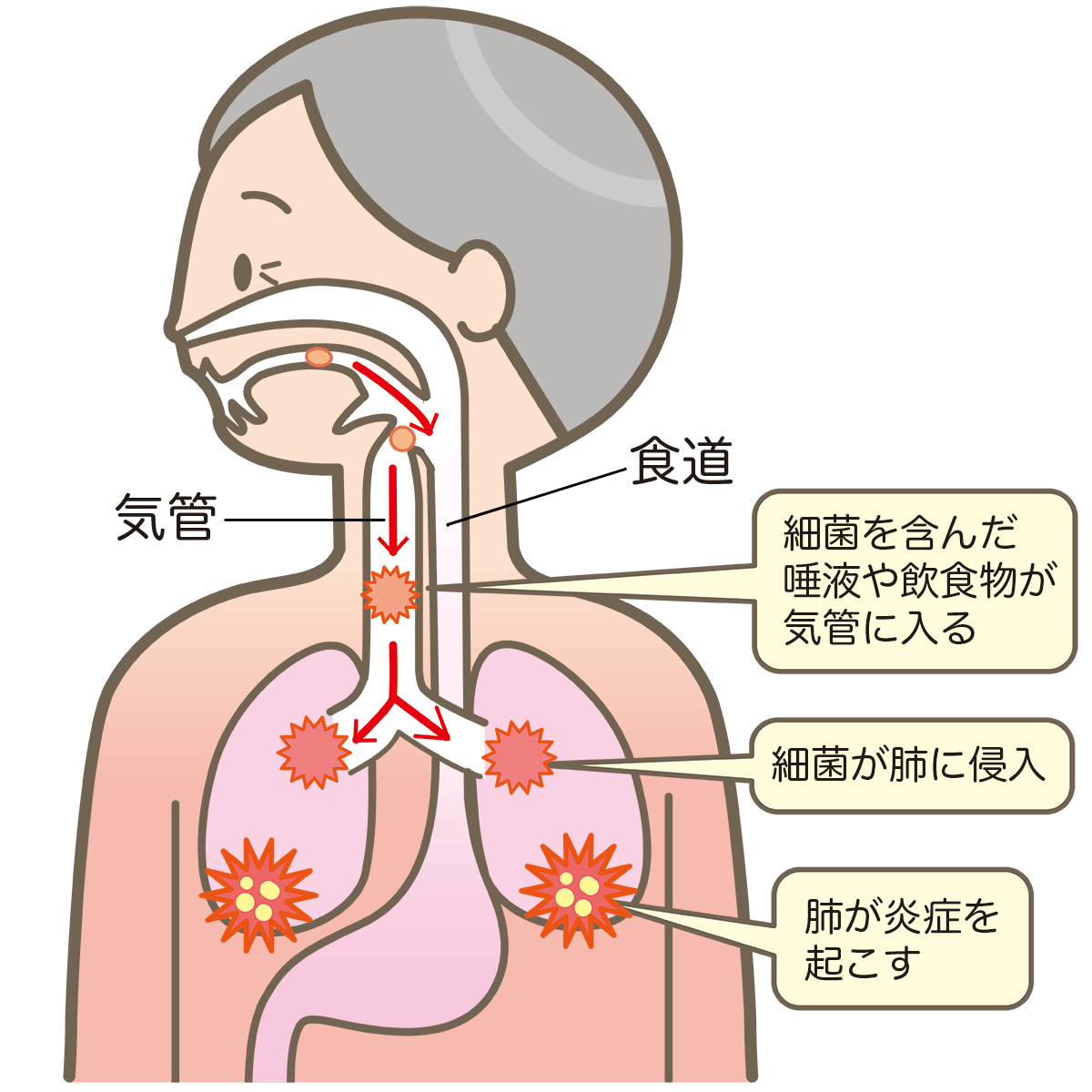 摂食嚥下障害について